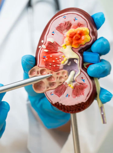 کلینیک ckd
